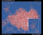 Lyme disease